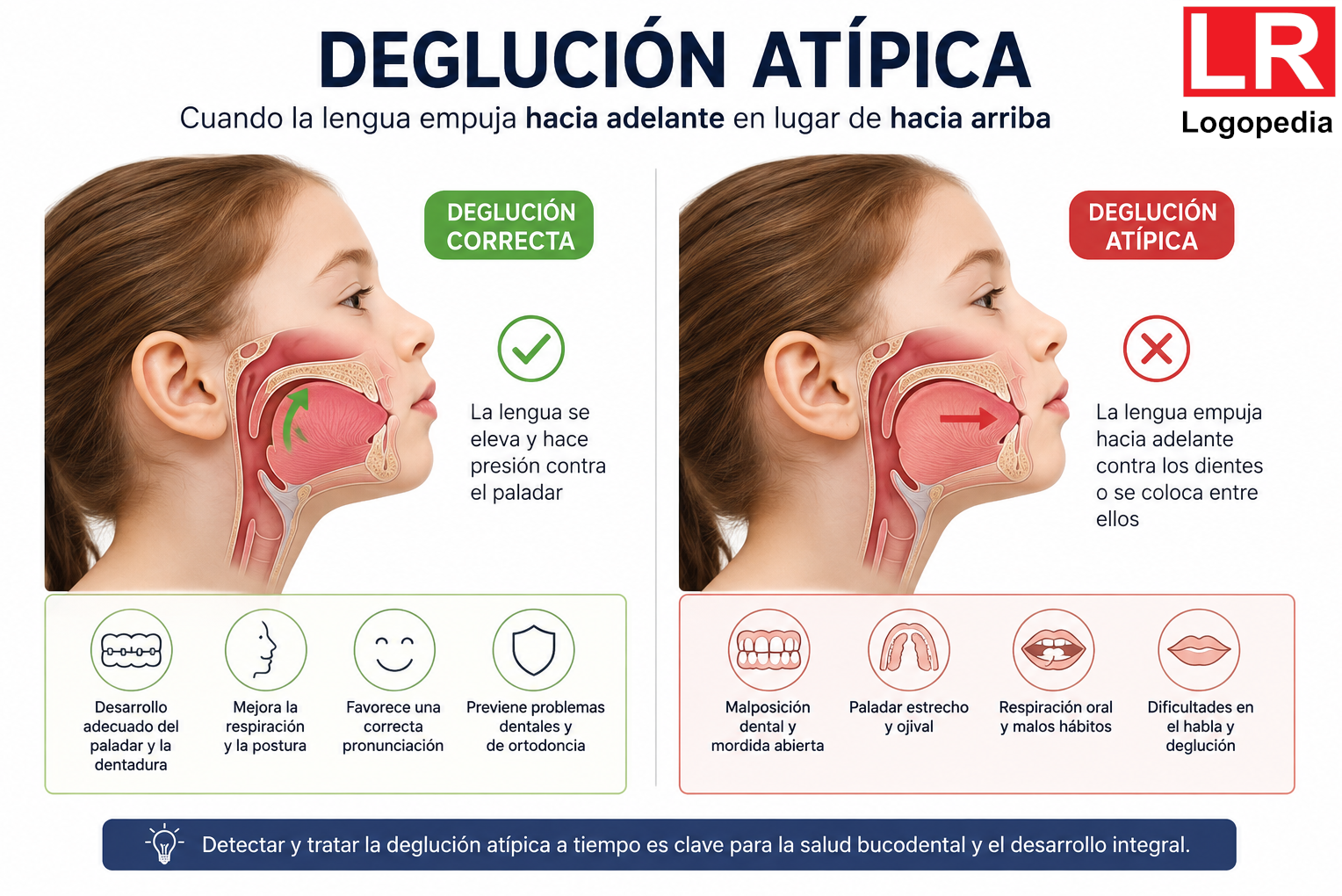 Deglución atípica
